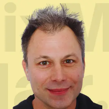 Hairline before treatment