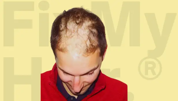 Before hair treatment.