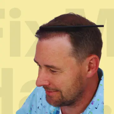 Hair Transformation After Treatment