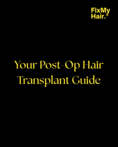 Hair Loss Treatment Options