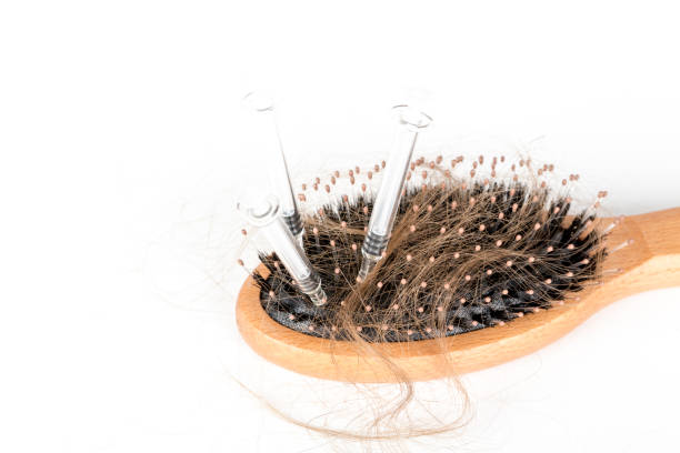 Non-Surgical Hair Loss