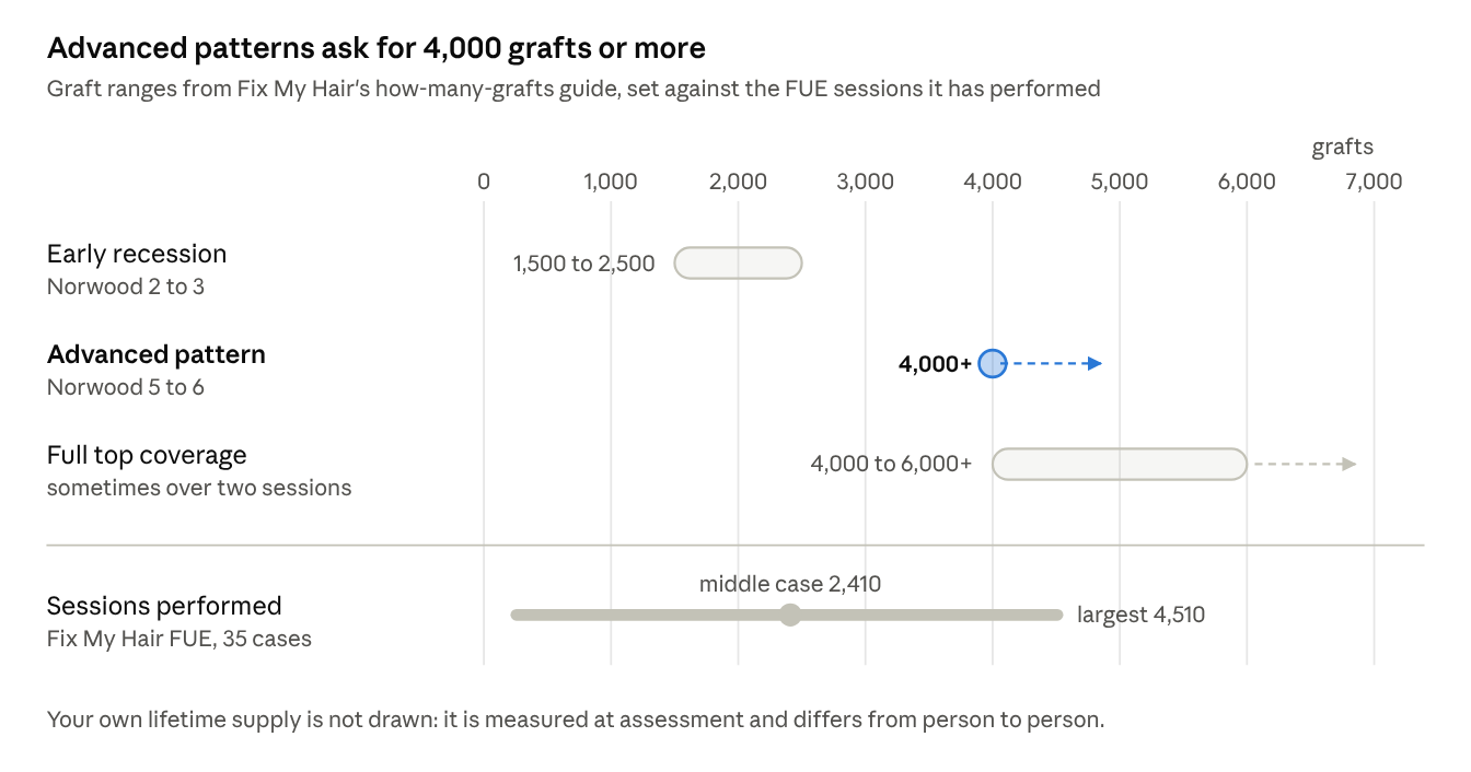 Advanced patterns ask for 4,000 grafts or more