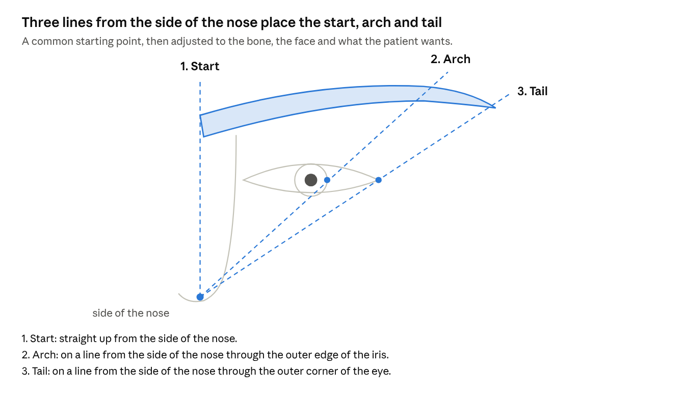 Three lines from the side of the nose place the start, arch and tail