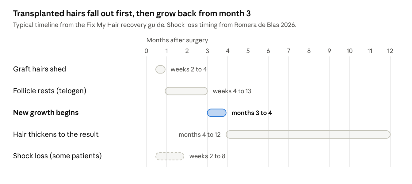 Transplanted hairs fall out first, then grow back from month 3